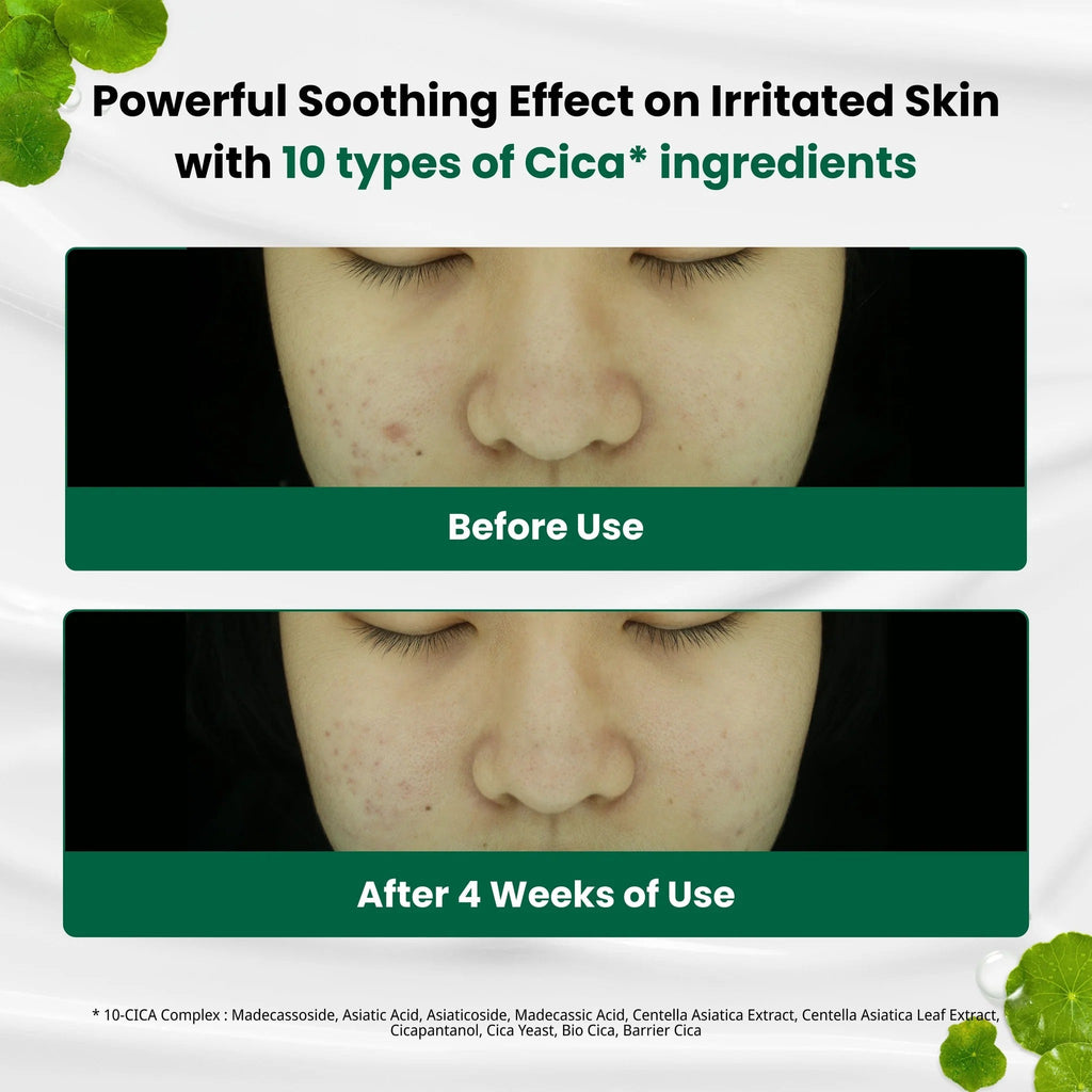 Dr.G R.E.D Blemish Clear Soothing Cream (70ml) - RV Cosmetics