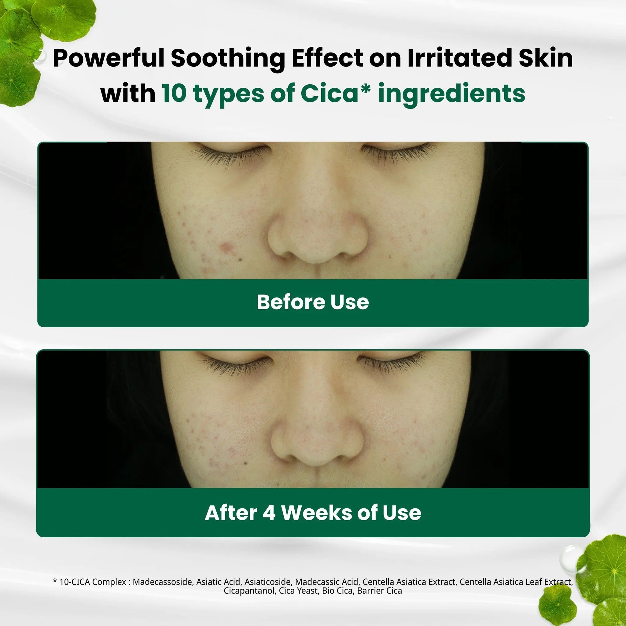 Dr.G R.E.D Blemish Clear Soothing Cream (70ml) - RV Cosmetics