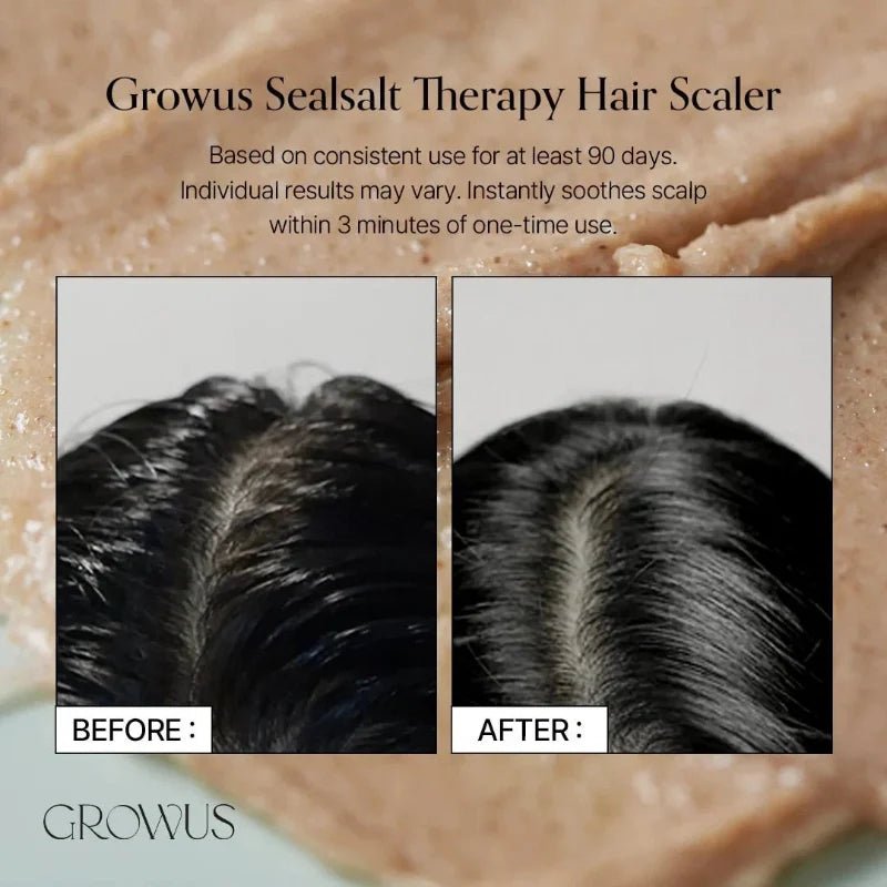 GROWUS Sea Salt Therapy Scalp Scaler 250g - RV Cosmetics
