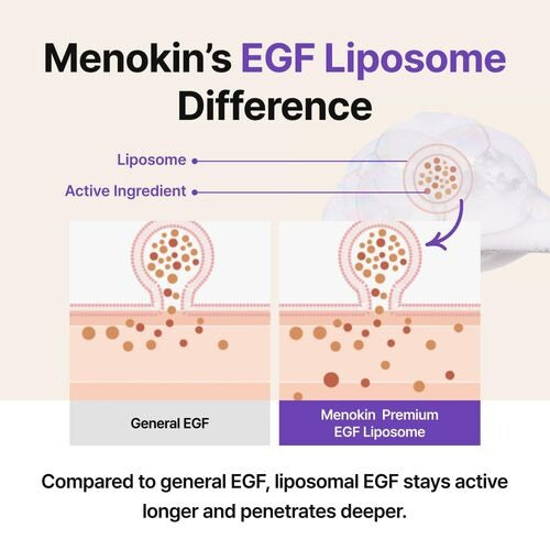 MENOKIN 30 Seconds Quick Bubble Mask 5 Types – Multi-Action Oxygen Foaming Mask