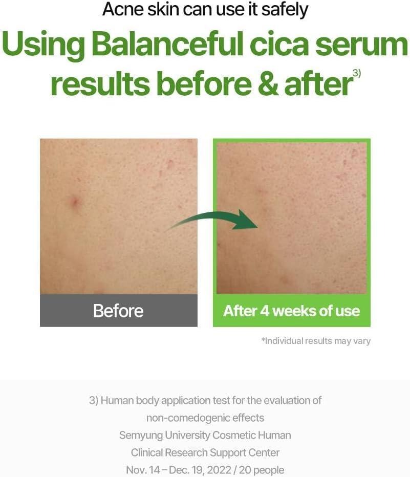 Torriden Balanceful Serum (50ml)