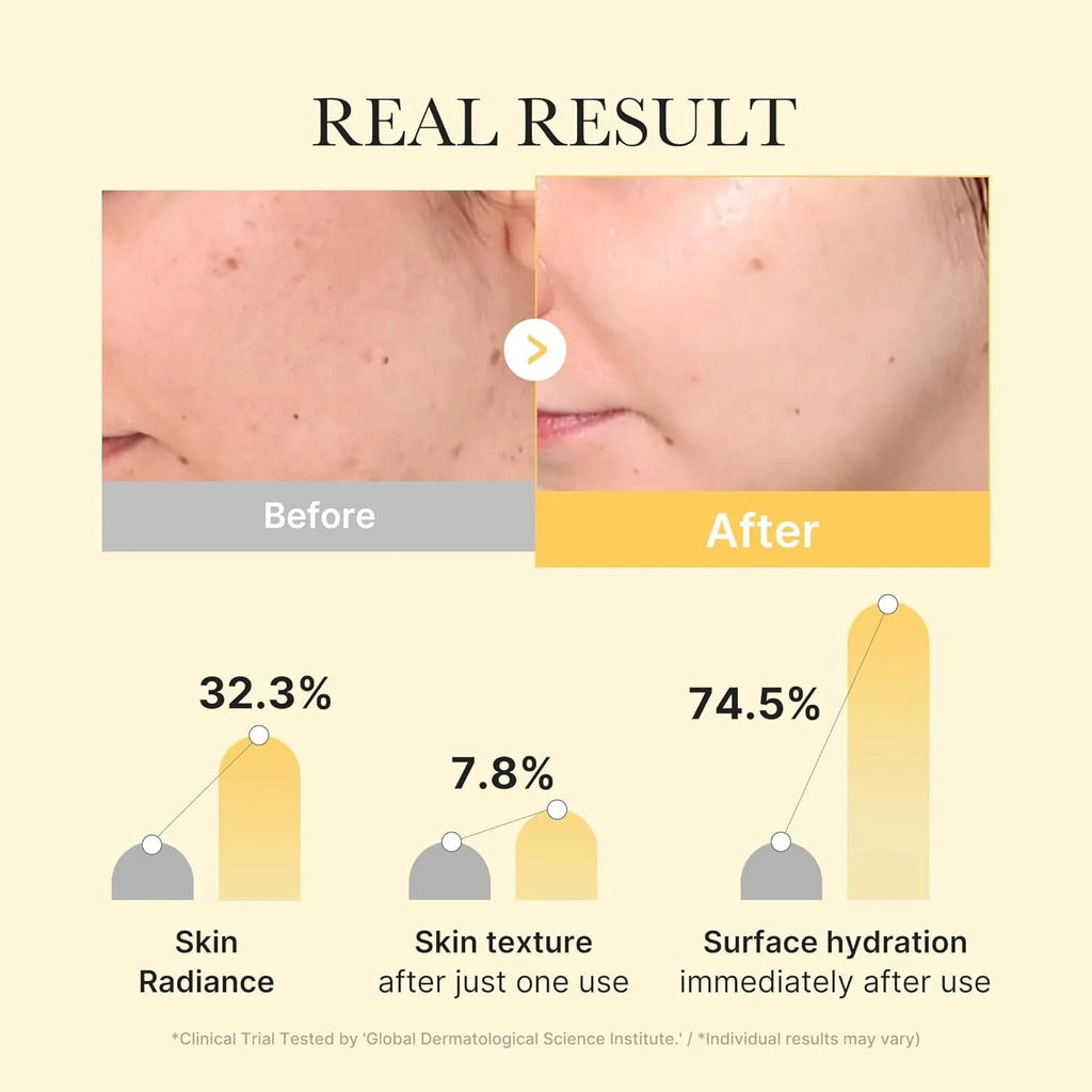 MEDICUBE Kojic Acid Turmeric Brightening Gel Mask – Radiance-Boosting Sheet Mask