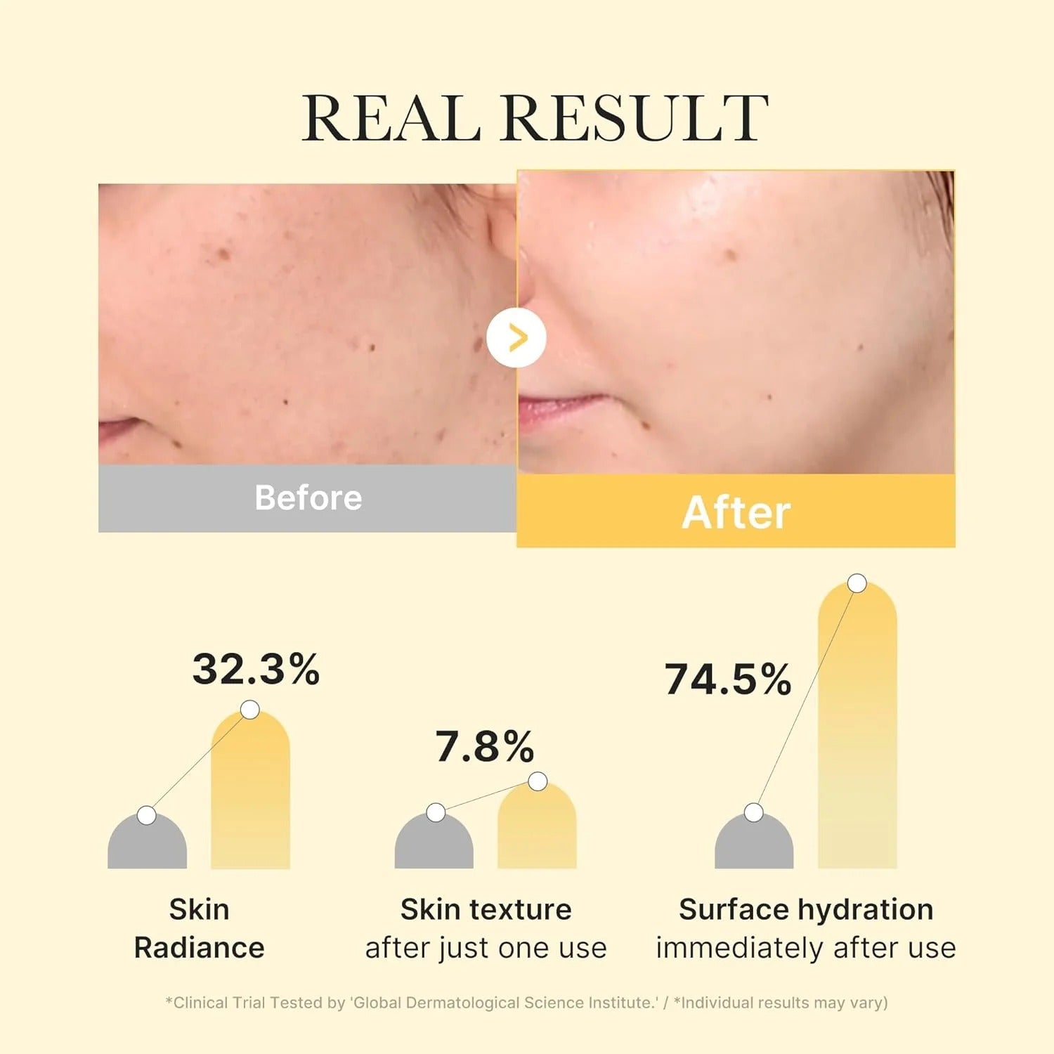 MEDICUBE Kojic Acid Turmeric Brightening Gel Mask – Radiance-Boosting Sheet Mask