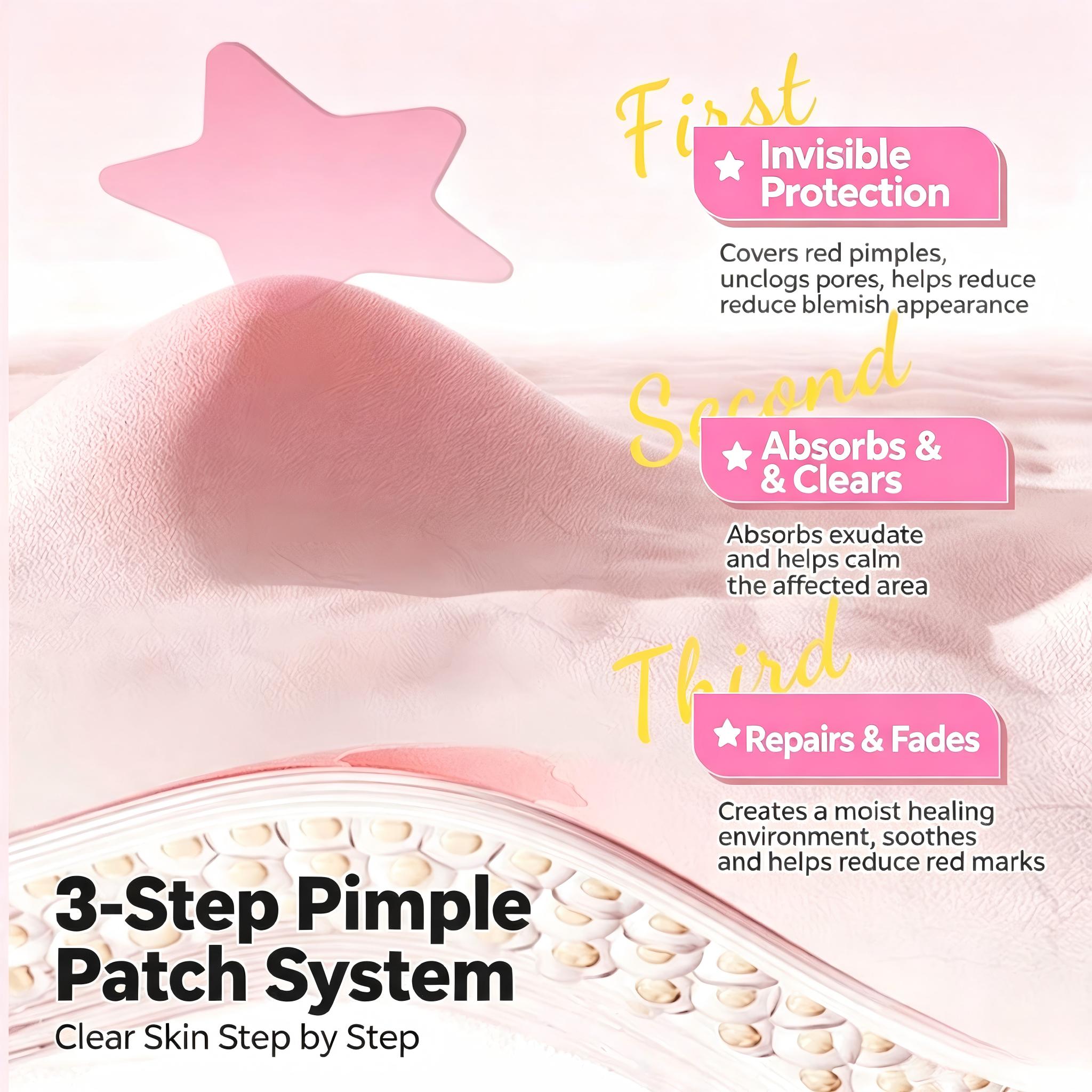 LMLTOP Star Acne Patches (36pcs) – Invisible Lightweight Breathable Spot Covers for Daily Blemish Care - RV Cosmetics