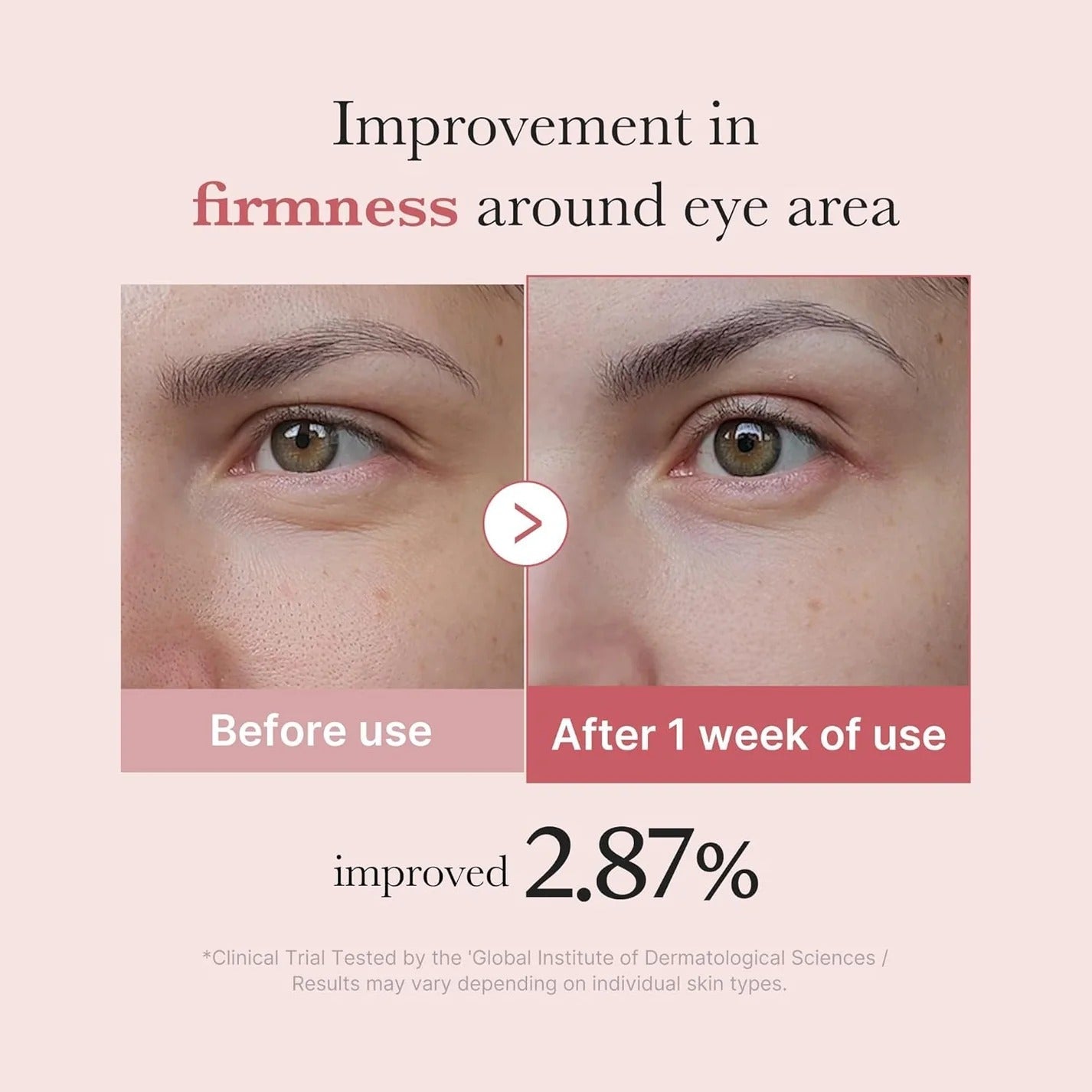 Medicube Pink Eye Cream with PDRN & Peptides (30ml) - RV Cosmetics