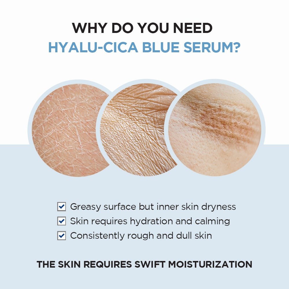 SKIN1004 Madagascar Centella Hyalu-Cica Blue Serum (50ml) - RV Cosmetics