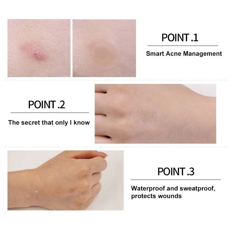 VT Cosmetics Cica Care Spot Patch Acne Relief (48pcs) - RV Cosmetics